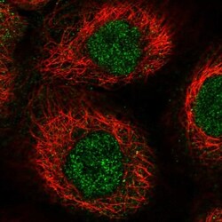 RHPN1 Antibody, Novus Biologicals 0.1mL; Unlabeled:Antibodies, Polyclonal